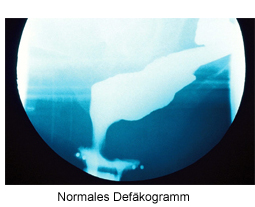 defaeko-normal-1